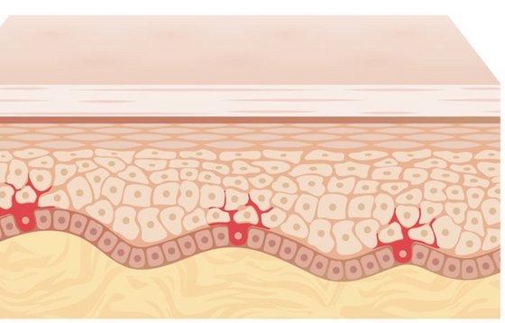 5 Things to know about Ceramides